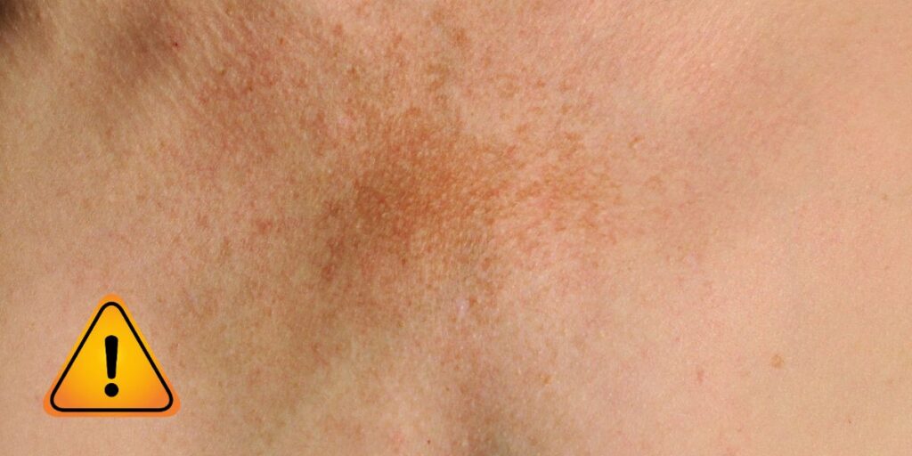 attention a votre peau